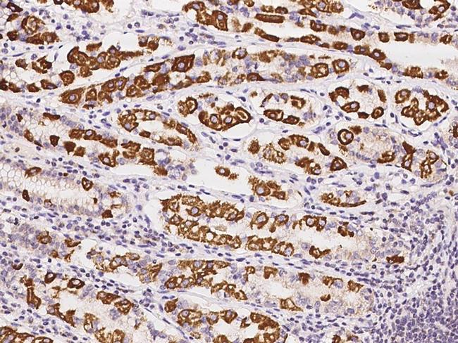 CBF beta Antibody in Immunohistochemistry (Paraffin) (IHC (P))