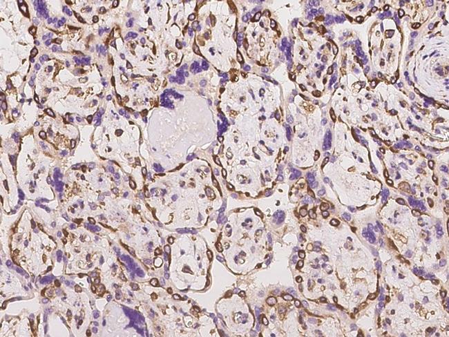 CD2AP Antibody in Immunohistochemistry (Paraffin) (IHC (P))