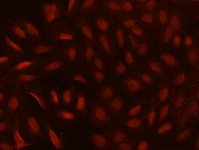 CDYL Antibody in Immunocytochemistry (ICC/IF)