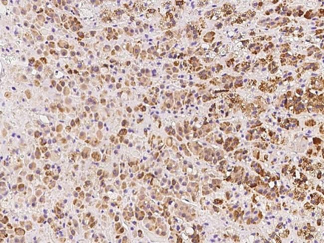 NARFL Antibody in Immunohistochemistry (Paraffin) (IHC (P))