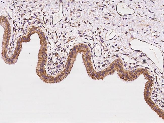 CLCC1 Antibody in Immunohistochemistry (Paraffin) (IHC (P))