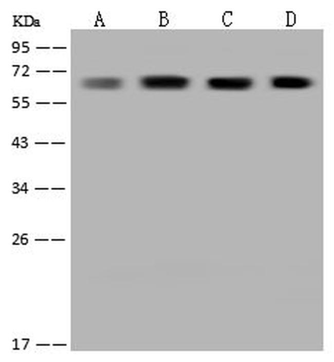 CoA Synthase Antibody in Western Blot (WB)