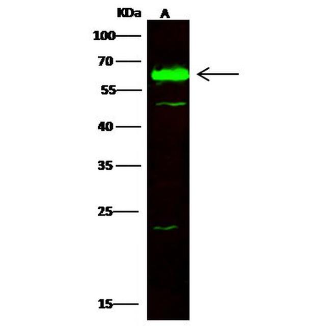 CPNE1 Antibody in Western Blot (WB)