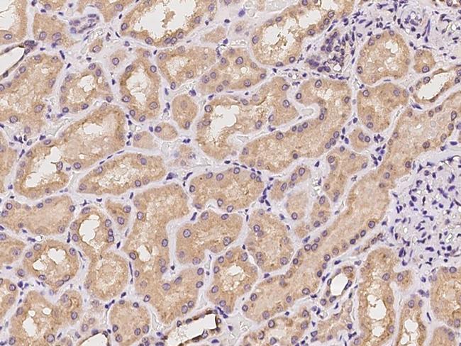 CRTAP Antibody in Immunohistochemistry (Paraffin) (IHC (P))