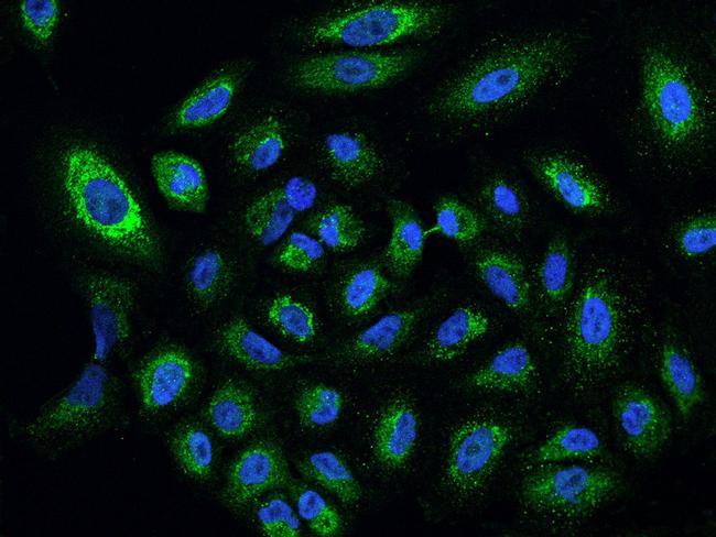 CYP24A1 Antibody in Immunocytochemistry (ICC/IF)