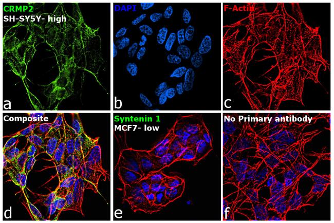 CRMP2 Antibody in Immunocytochemistry (ICC/IF)