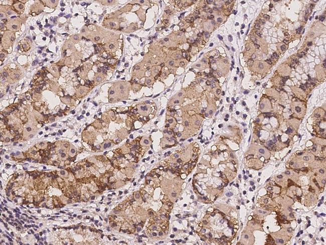 DTYMK Antibody in Immunohistochemistry (Paraffin) (IHC (P))