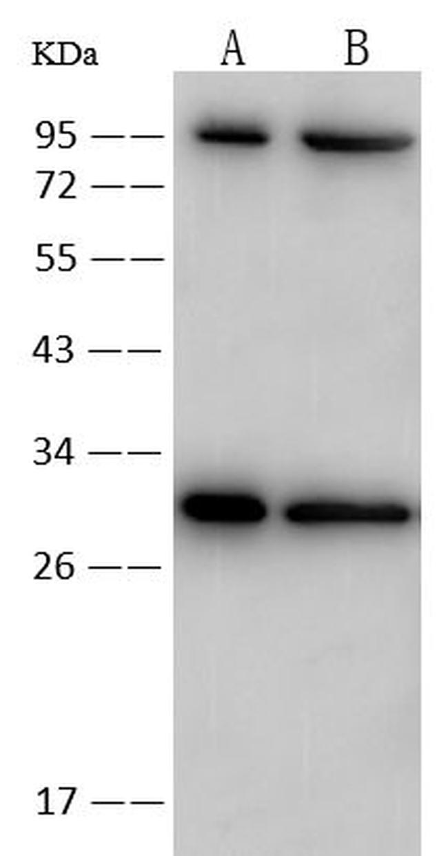 CD105 Antibody in Western Blot (WB)