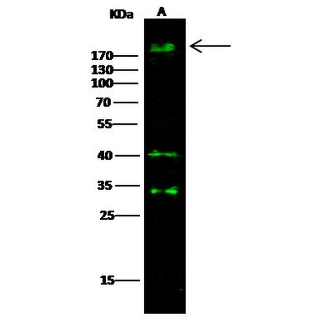 ErbB3 Antibody in Western Blot (WB)