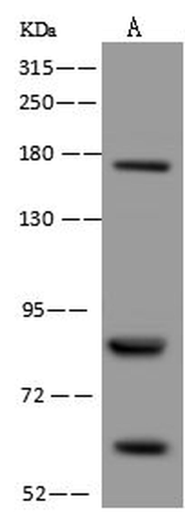 EXOC8 Antibody in Western Blot (WB)