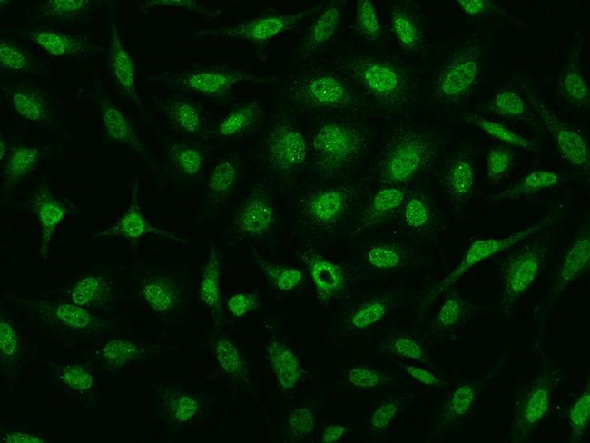 FOXM1 Antibody in Immunocytochemistry (ICC/IF)