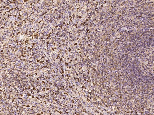 G6PD Antibody in Immunohistochemistry (Paraffin) (IHC (P))