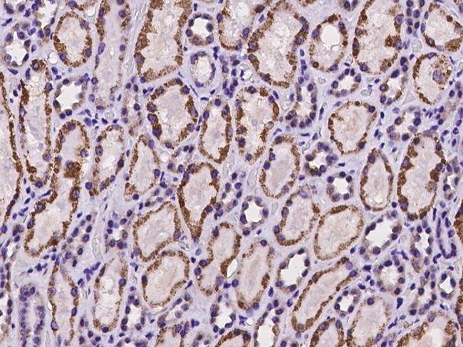 HIBCH Antibody in Immunohistochemistry (Paraffin) (IHC (P))