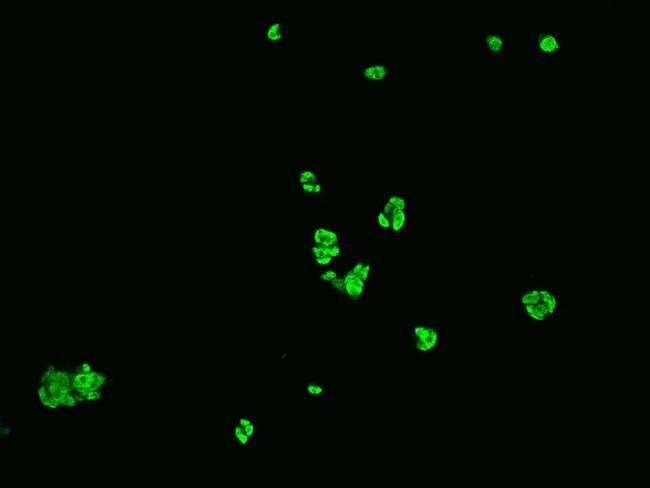 hnRNP C Antibody in Immunocytochemistry (ICC/IF)