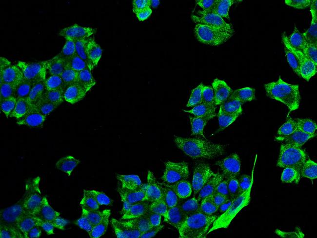 Cytokeratin 8 Antibody in Immunocytochemistry (ICC/IF)