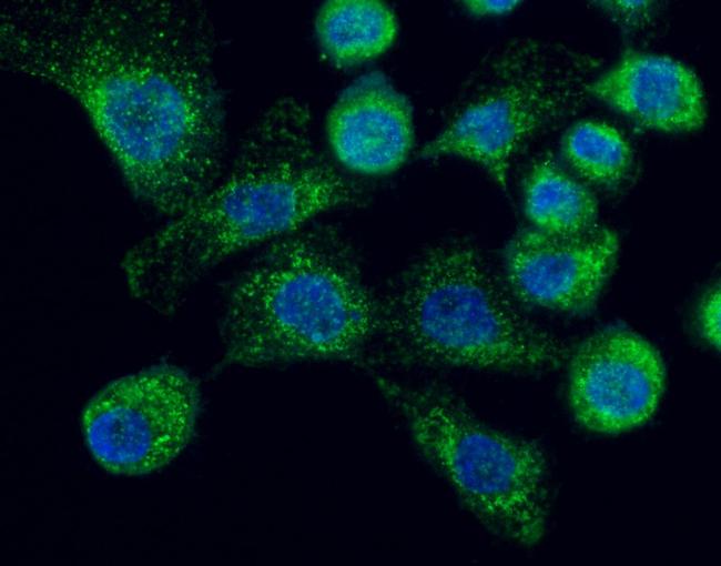 LAMP2 Antibody in Immunocytochemistry (ICC/IF)