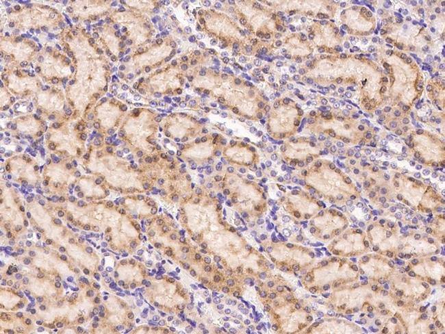 Leptin Receptor Antibody in Immunohistochemistry (Paraffin) (IHC (P))