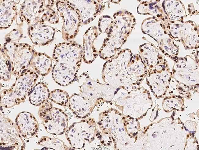 MAGEA10 Antibody in Immunohistochemistry (Paraffin) (IHC (P))