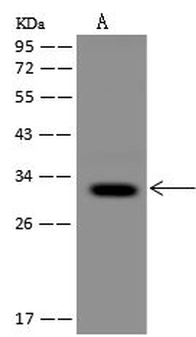 MCU Antibody in Western Blot (WB)