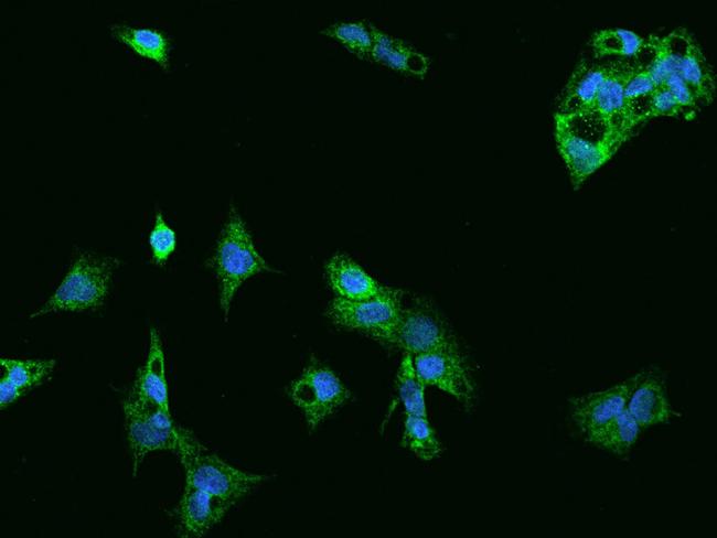 MFN2 Antibody in Immunocytochemistry (ICC/IF)