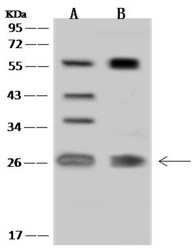 MIS12 Antibody in Western Blot (WB)