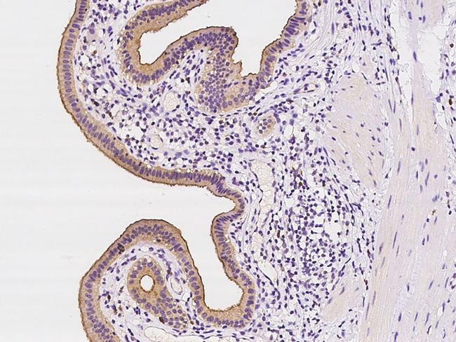 MLPH Antibody in Immunohistochemistry (Paraffin) (IHC (P))