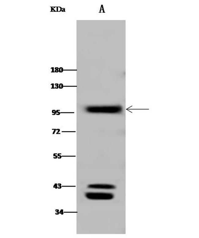 CD10 Antibody in Western Blot (WB)