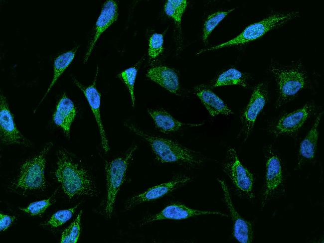 MUT Antibody in Immunocytochemistry (ICC/IF)