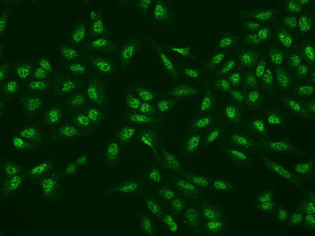 MRI1 Antibody in Immunocytochemistry (ICC/IF)