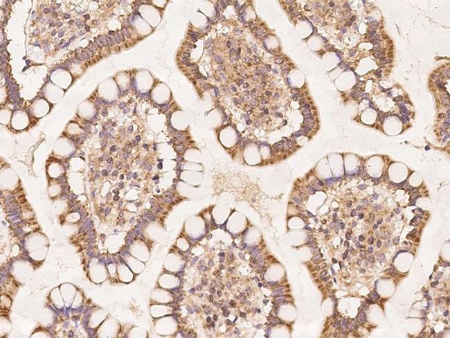 MRPL11 Antibody in Immunohistochemistry (Paraffin) (IHC (P))