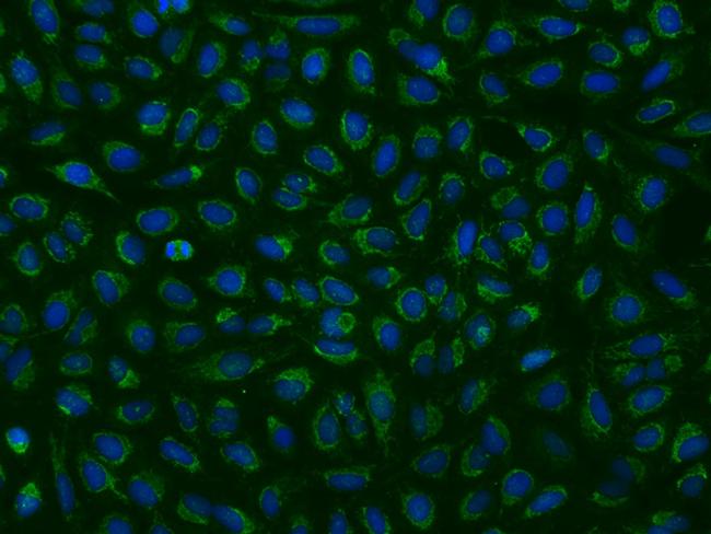 MRPL9 Antibody in Immunocytochemistry (ICC/IF)