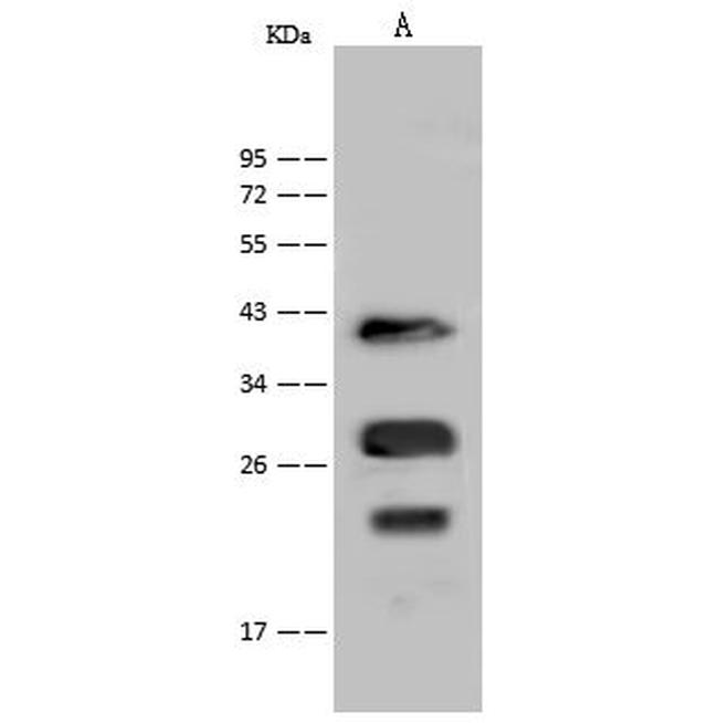 Nkx3.1 Antibody in Western Blot (WB)