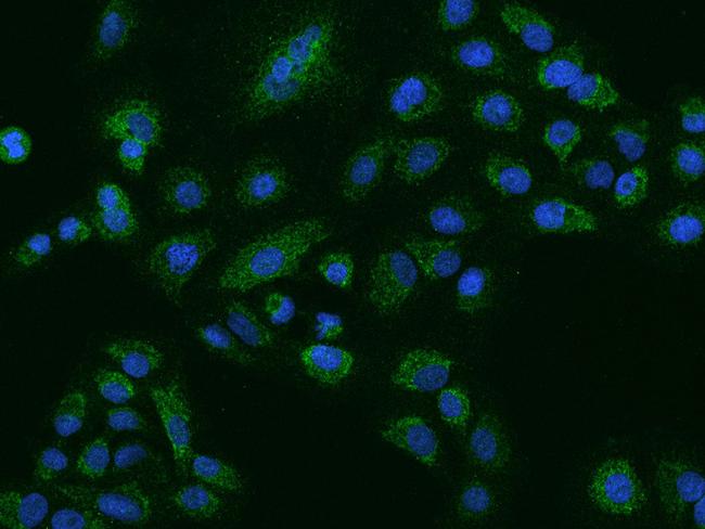 NLRX1 Antibody in Immunocytochemistry (ICC/IF)