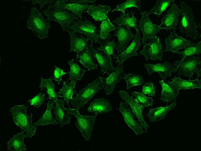 NOTCH2 Antibody in Immunocytochemistry (ICC/IF)