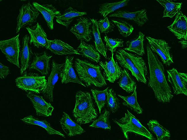 Palladin Antibody in Immunocytochemistry (ICC/IF)