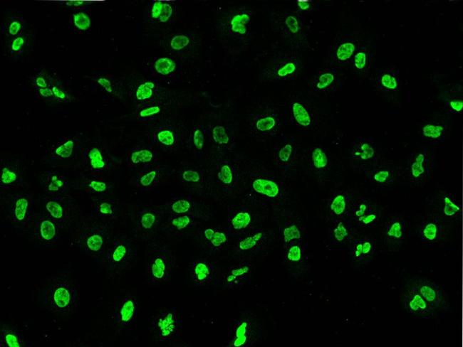 PAX2 Antibody in Immunocytochemistry (ICC/IF)