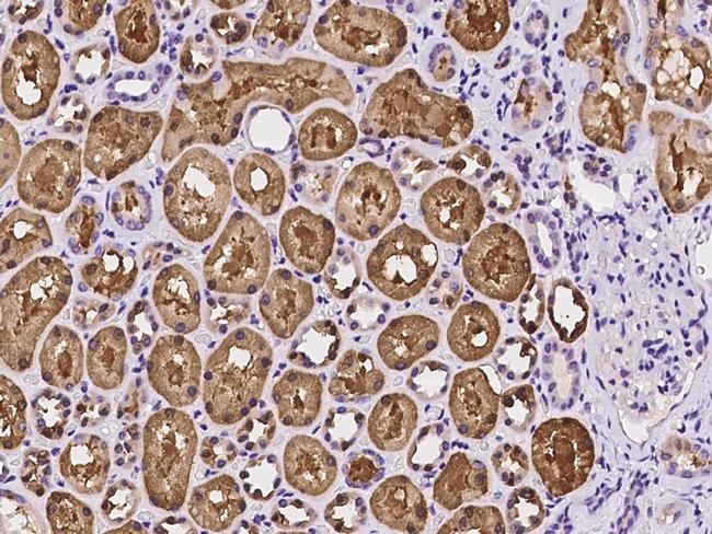 PCK1 Antibody in Immunohistochemistry (Paraffin) (IHC (P))