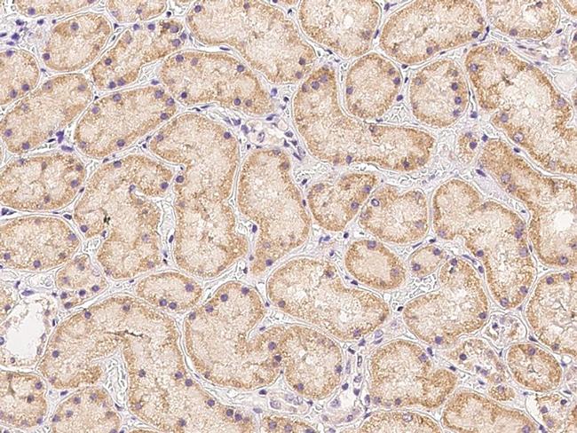 PDSS2 Antibody in Immunohistochemistry (Paraffin) (IHC (P))