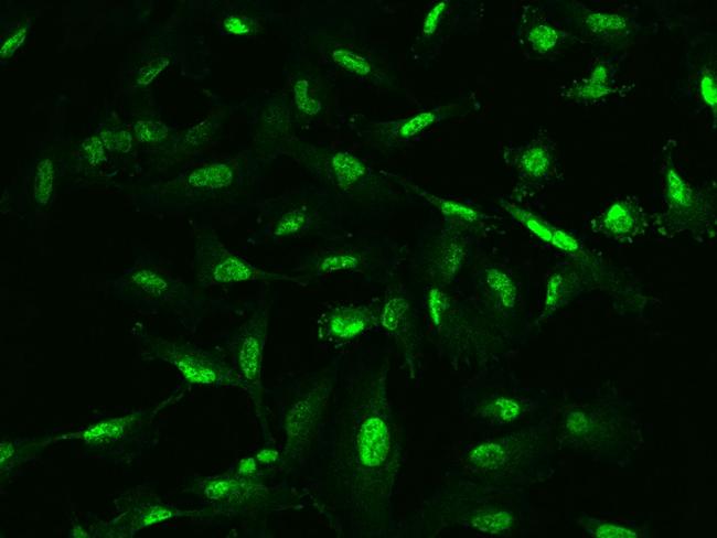 PLCD1 Antibody in Immunocytochemistry (ICC/IF)