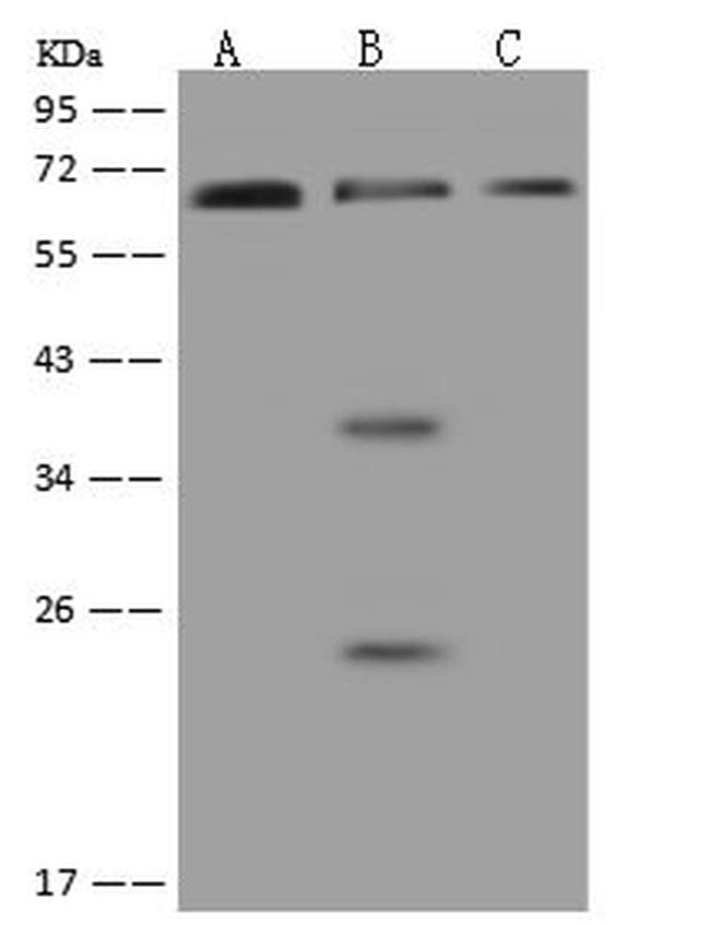 PNK Antibody in Western Blot (WB)