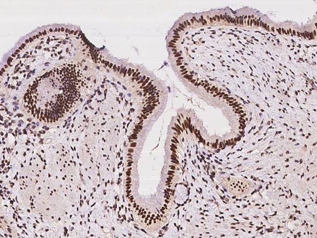 POLB Antibody in Immunohistochemistry (Paraffin) (IHC (P))