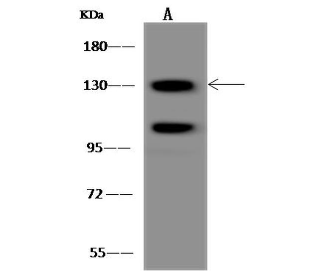 POLR2B Antibody in Western Blot (WB)