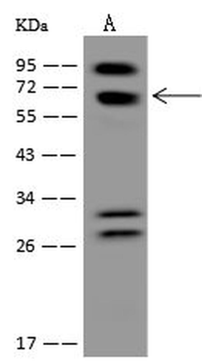 POMGNT2 Antibody in Western Blot (WB)