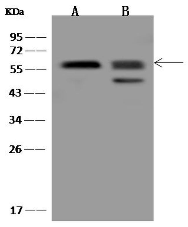 PPAT Antibody in Western Blot (WB)