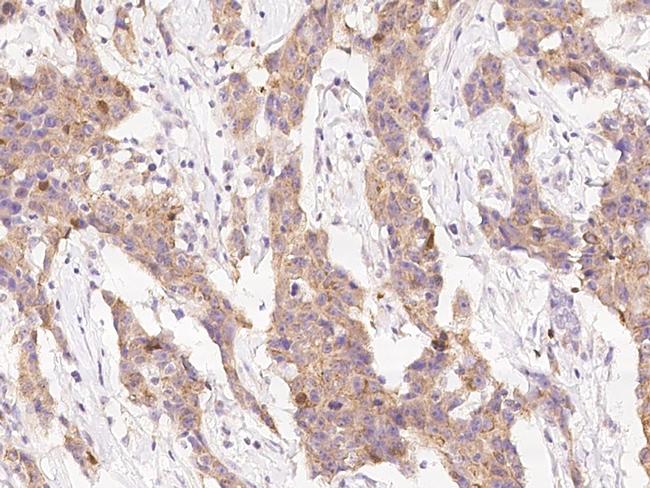 PPM1A Antibody in Immunohistochemistry (Paraffin) (IHC (P))