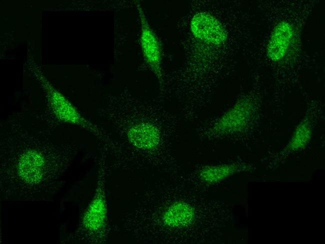 PSMB8 Antibody in Immunocytochemistry (ICC/IF)