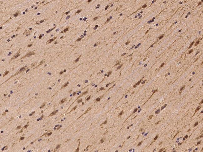 PSMC5 Antibody in Immunohistochemistry (Paraffin) (IHC (P))