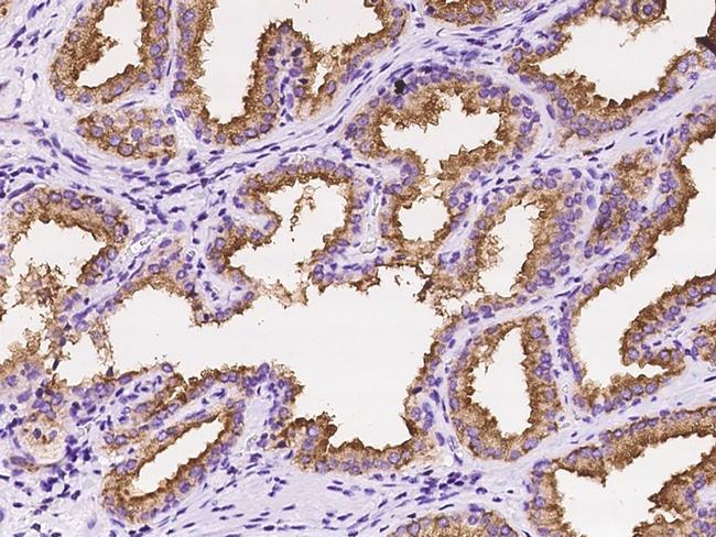 RAB27A Antibody in Immunohistochemistry (Paraffin) (IHC (P))