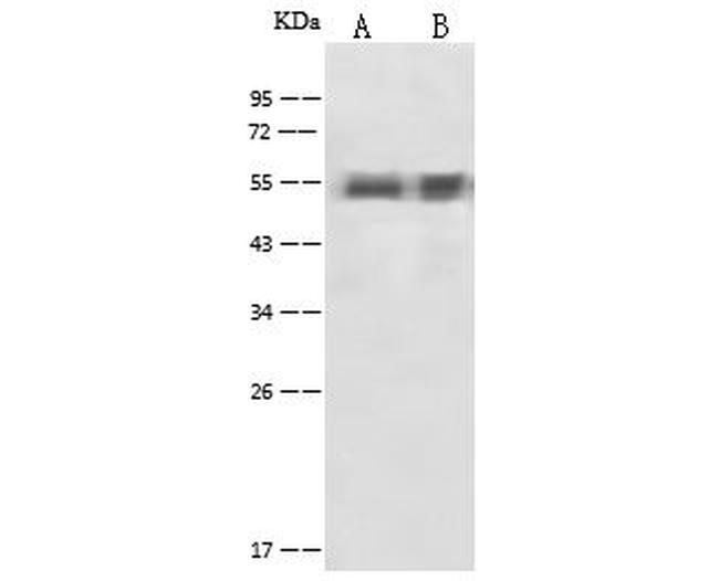 alpha-1 Antitrypsin Antibody in Western Blot (WB)