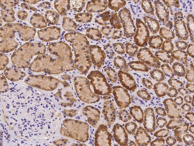 ORNT1 Antibody in Immunohistochemistry (Paraffin) (IHC (P))